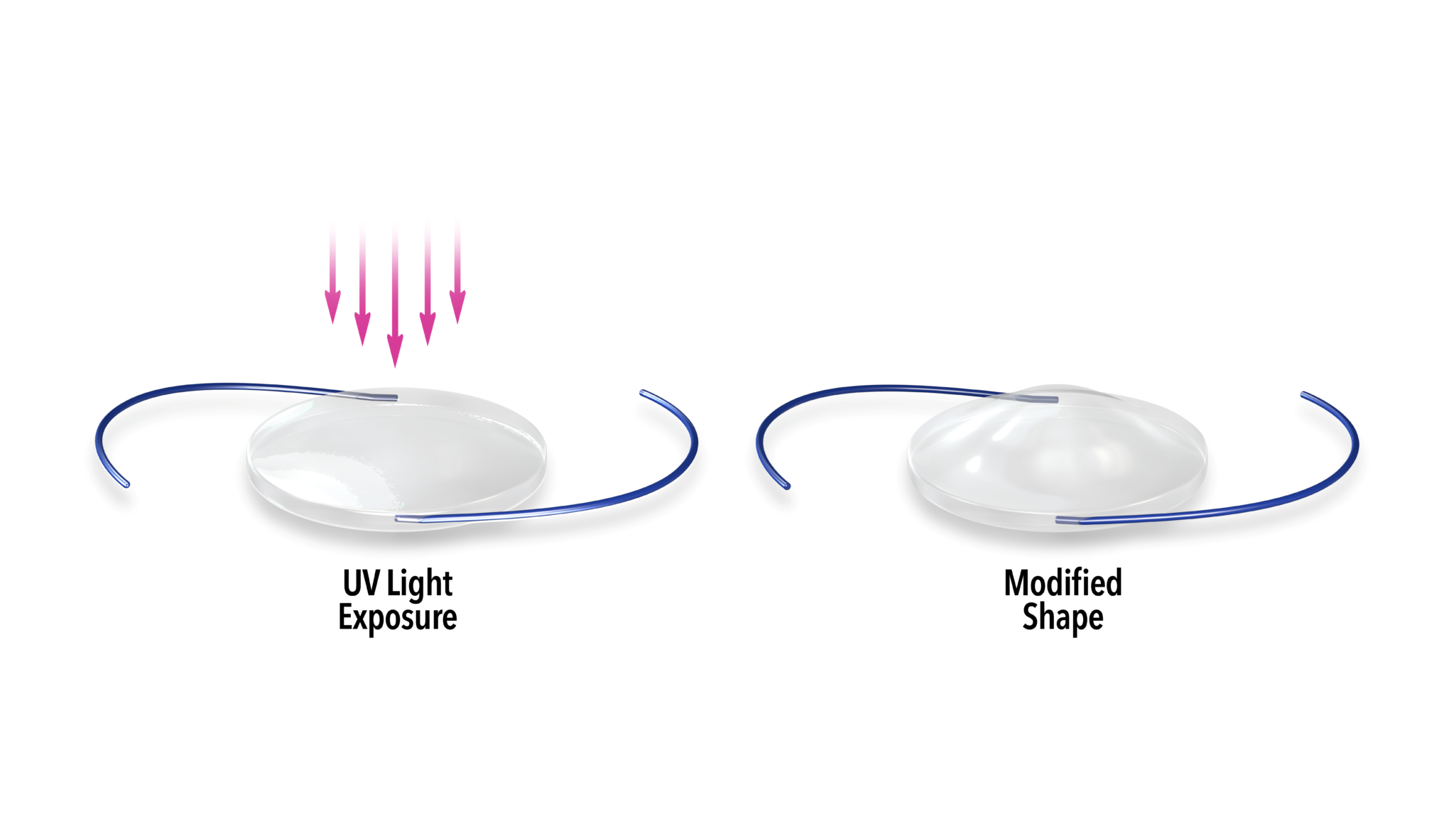 illustration showing how light adjustable lenses react to light