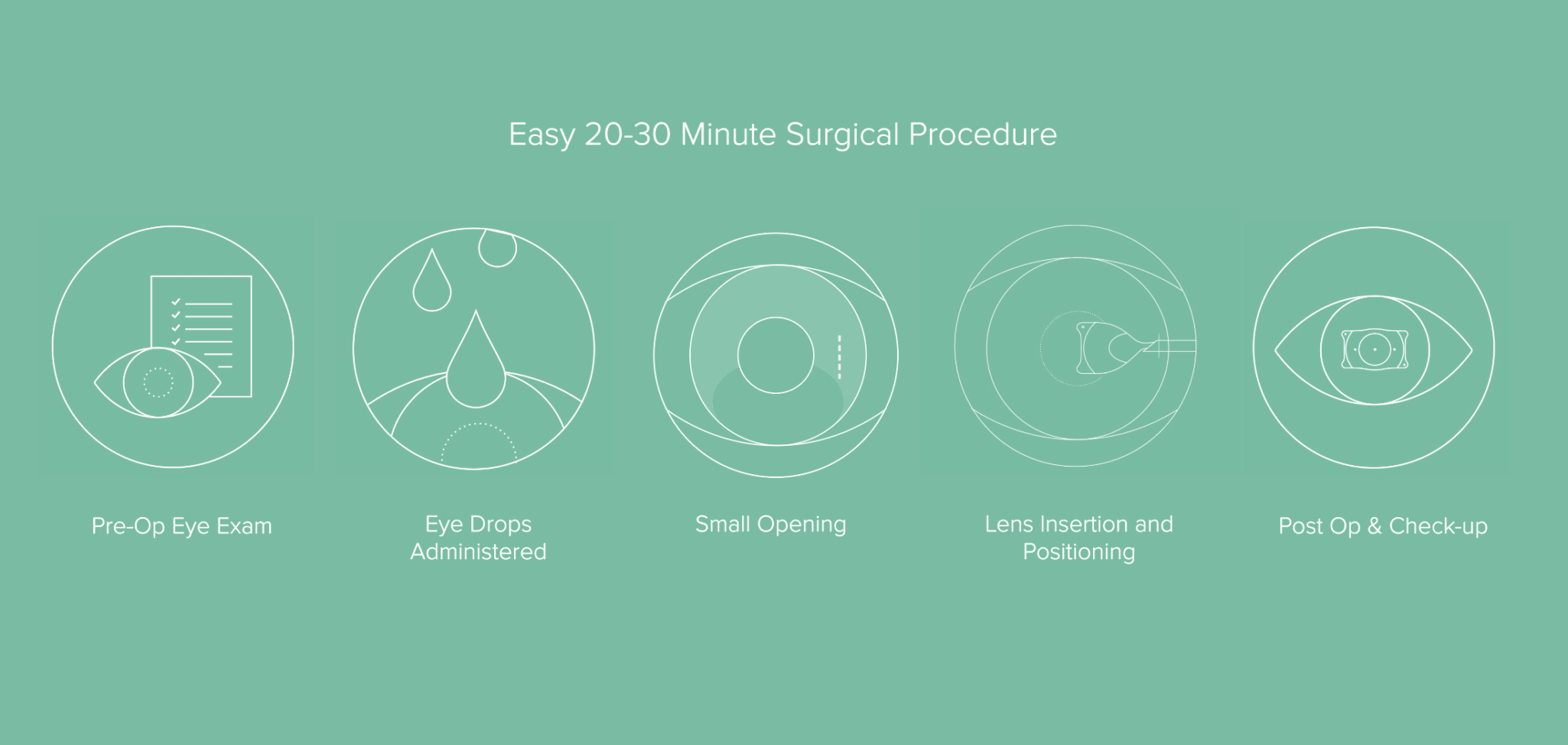 EVO ICL Procedure