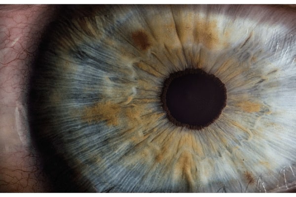 1770402498_photo-1483519173755-be893fab1f46-1-1 inSight Learning Series By Richens Eye Center