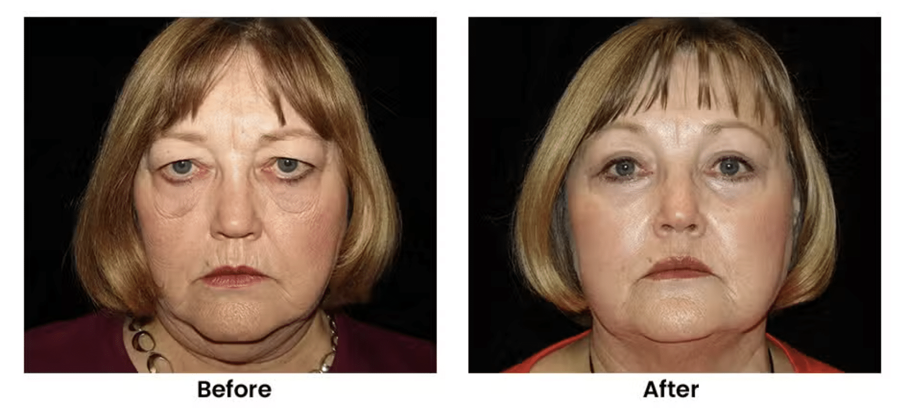 Screenshot 2026-02-12 at 1.10.47 PM